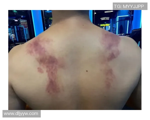 足球明星如何利用筋膜刀提升竞技状态与恢复效果揭秘